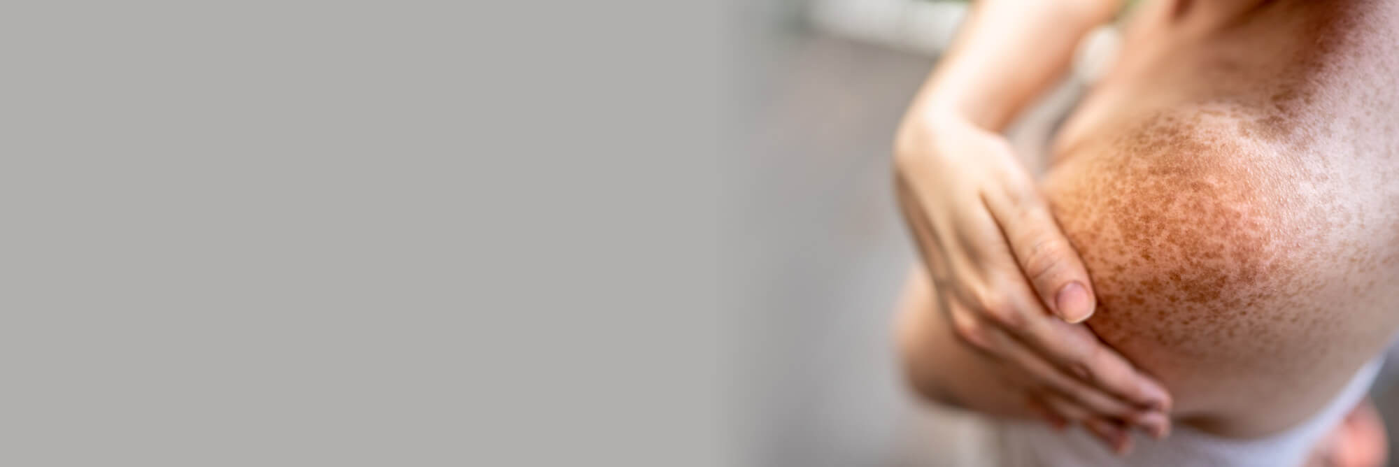 Terrigal Skin Cancer Clinic